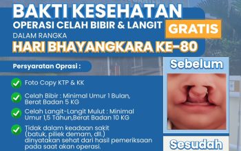 Polda Banten Gelar Bakti Kesehatan Gratis Sambut Hari Bhayangkara ke-80