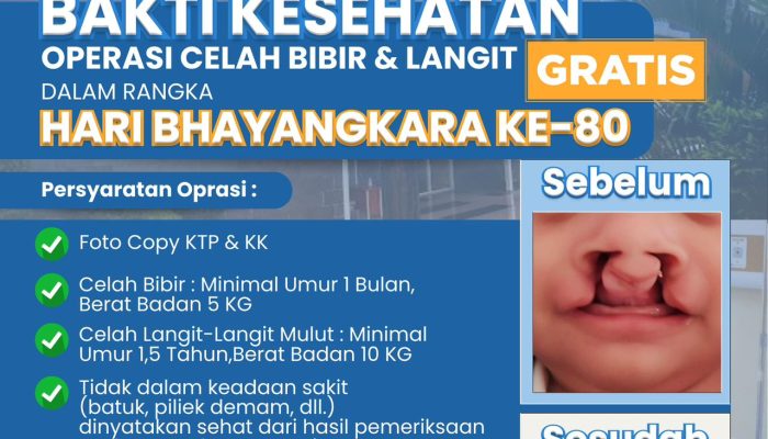 Polda Banten Gelar Bakti Kesehatan Gratis Sambut Hari Bhayangkara ke-80