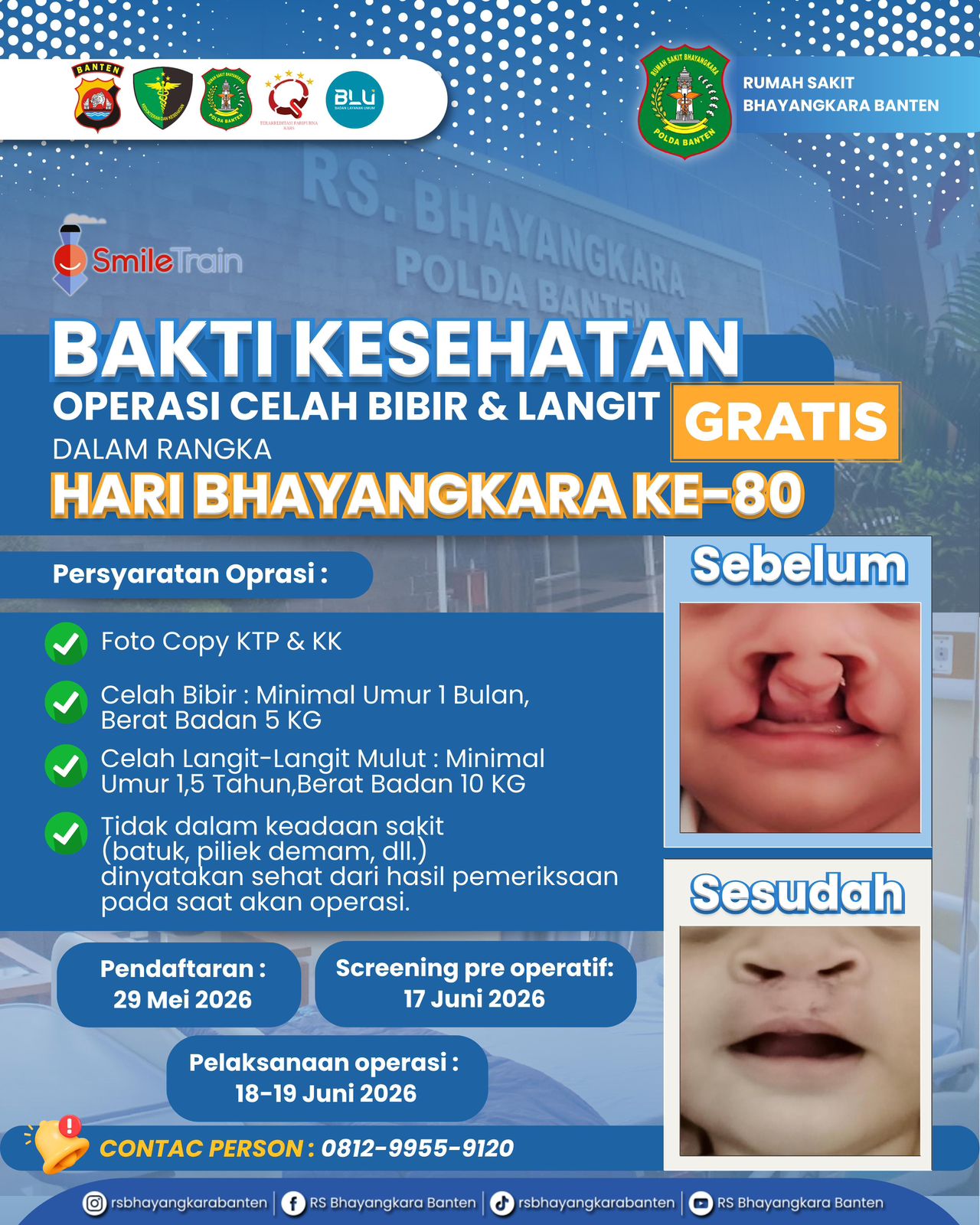 Polda Banten Gelar Bakti Kesehatan Gratis Sambut Hari Bhayangkara ke-80